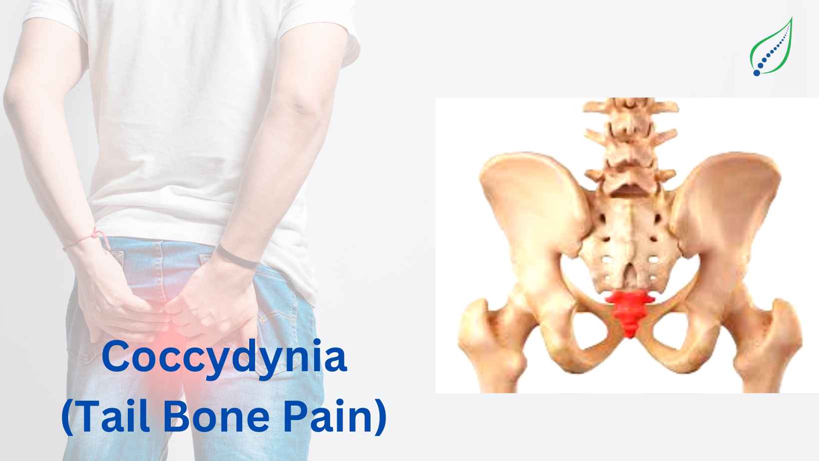 Coccydynia